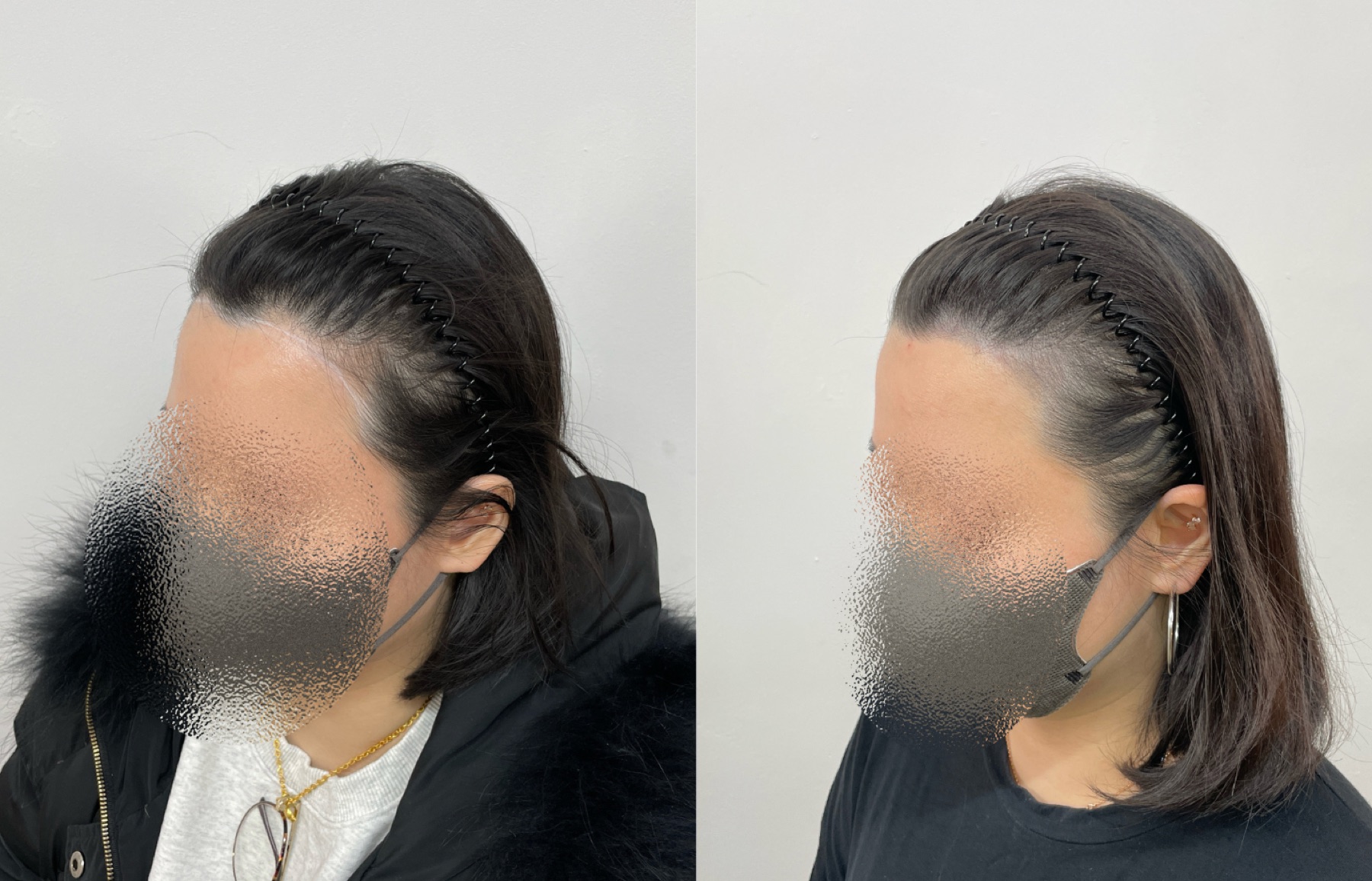 Hairline SMP portfolio 9