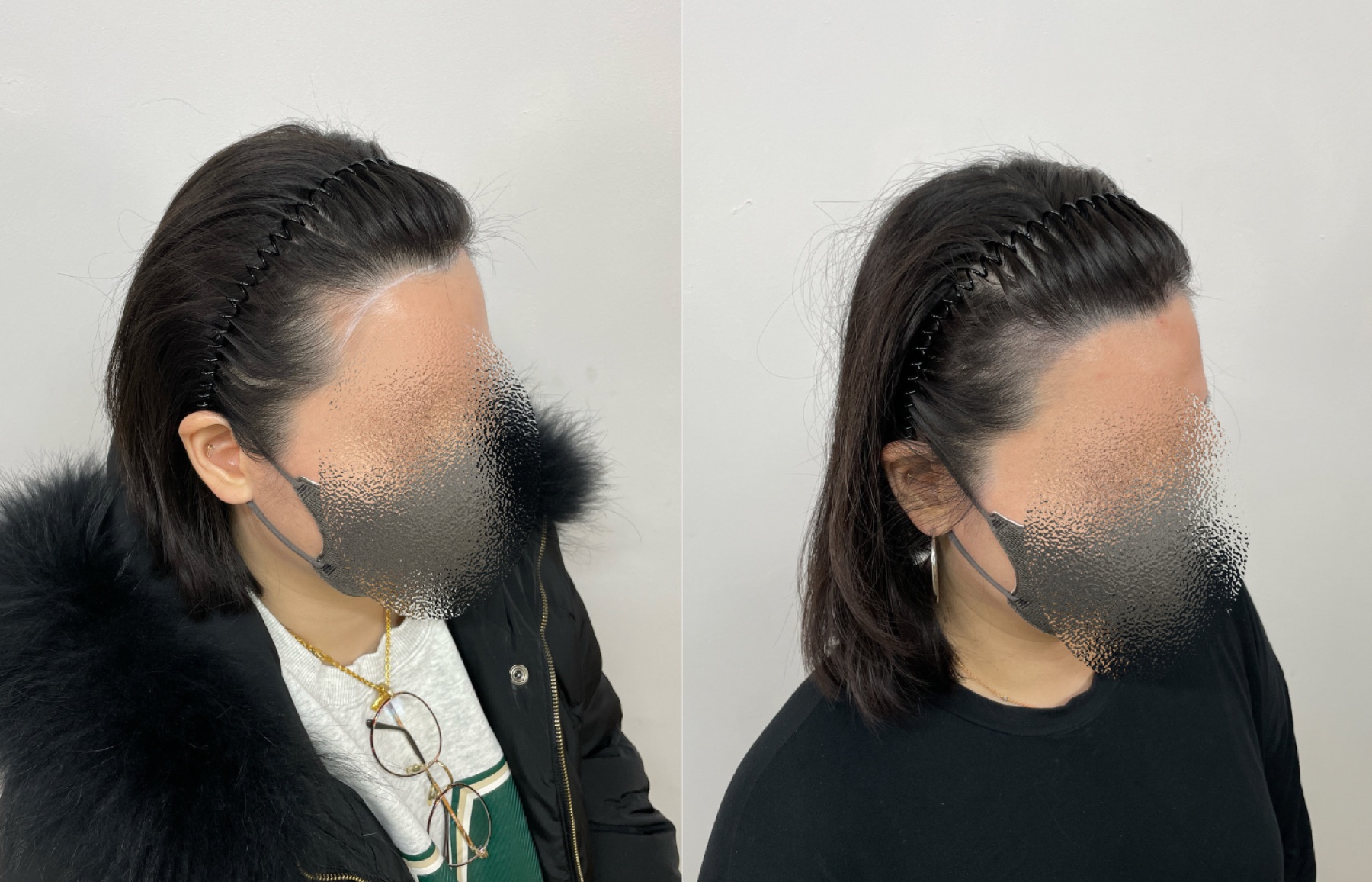 Hairline SMP portfolio 10
