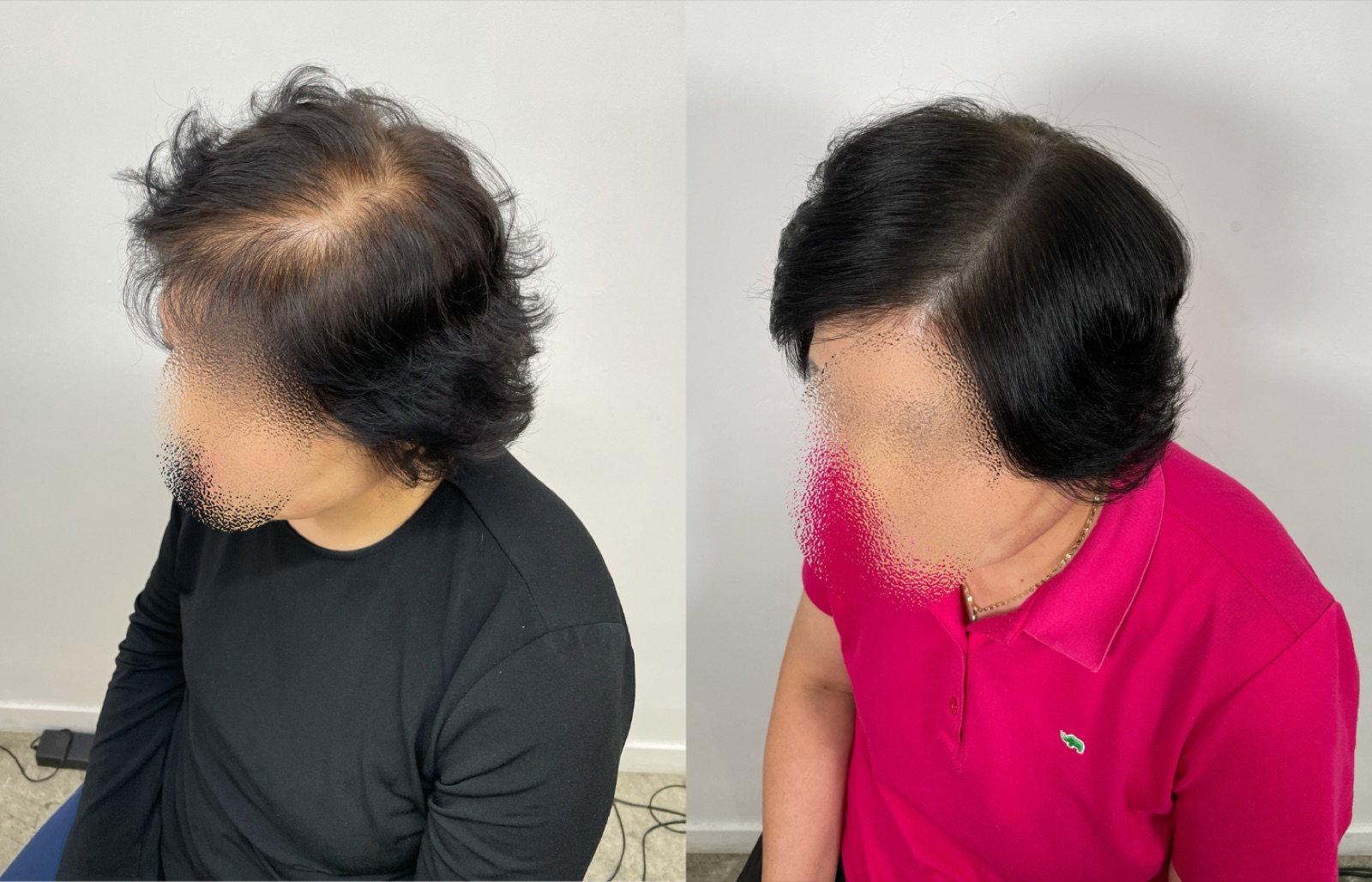 Hairline SMP portfolio 2