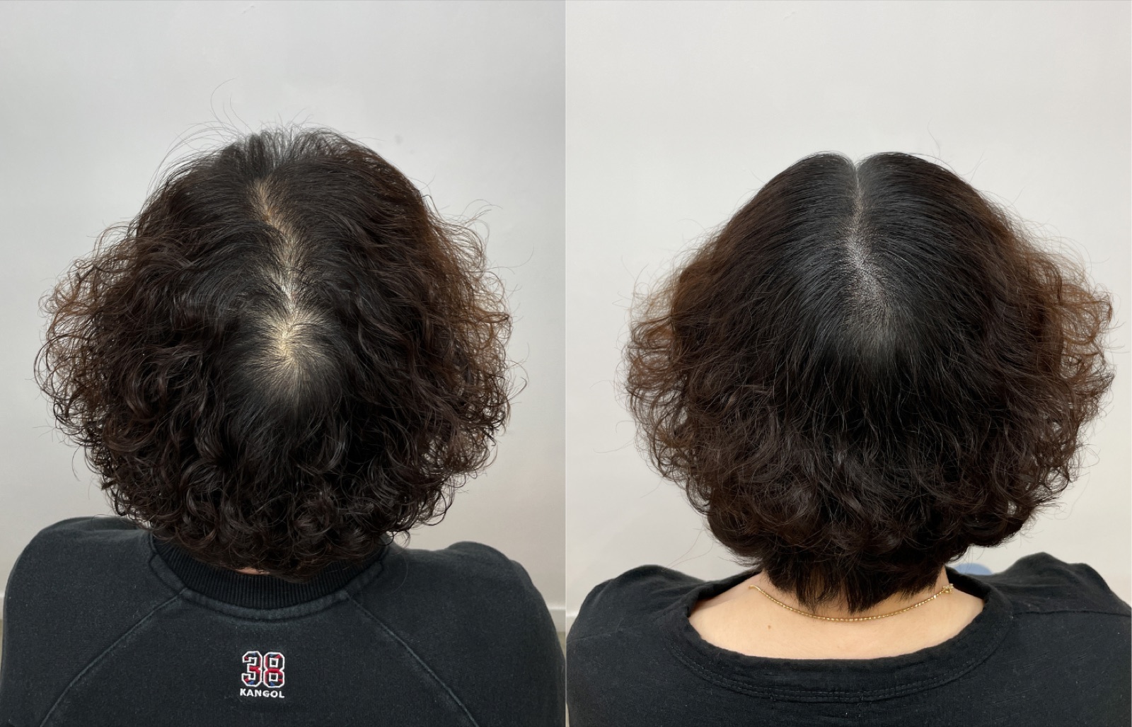 Hairline SMP portfolio 6