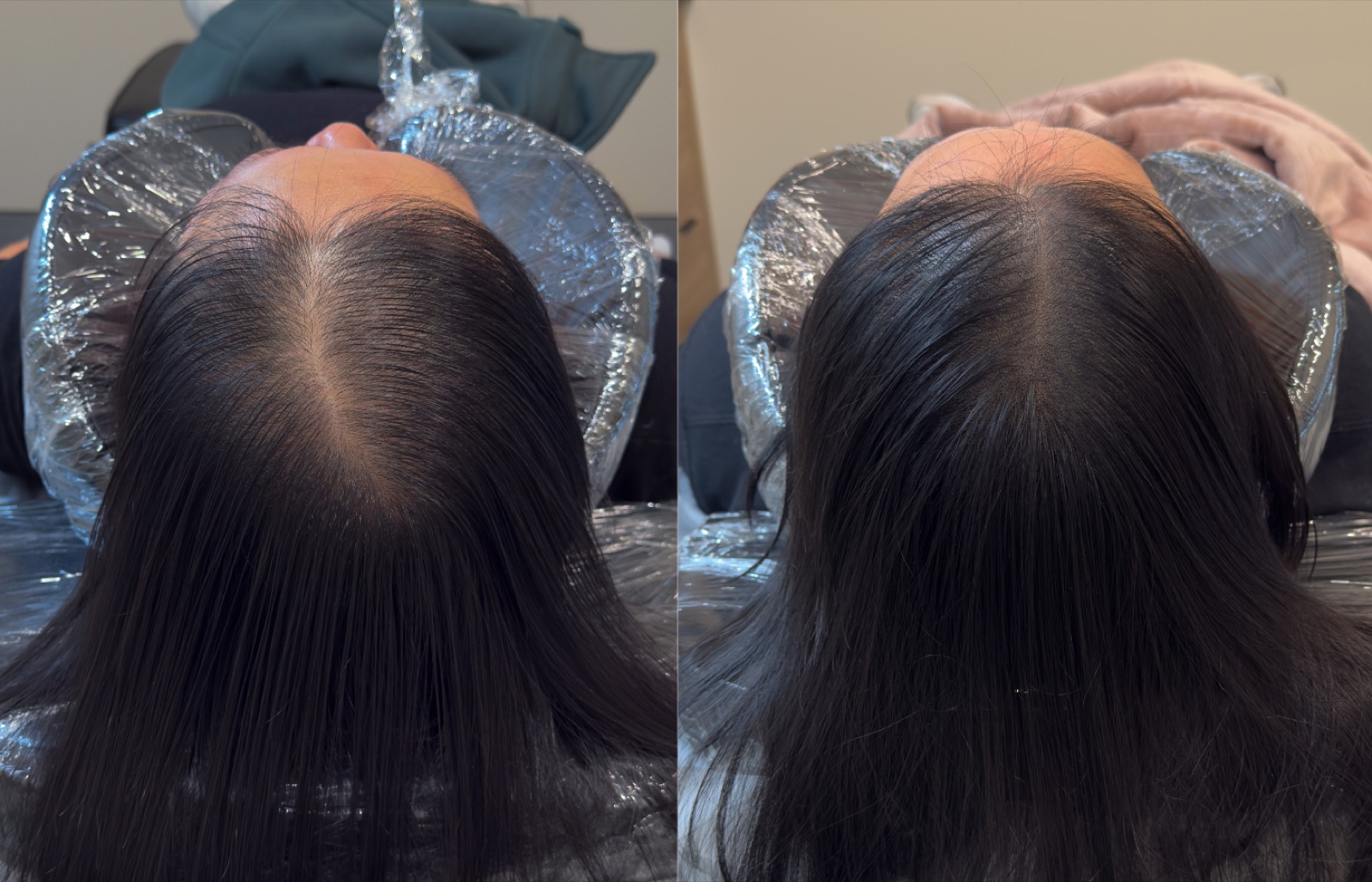 Hairline SMP portfolio 9