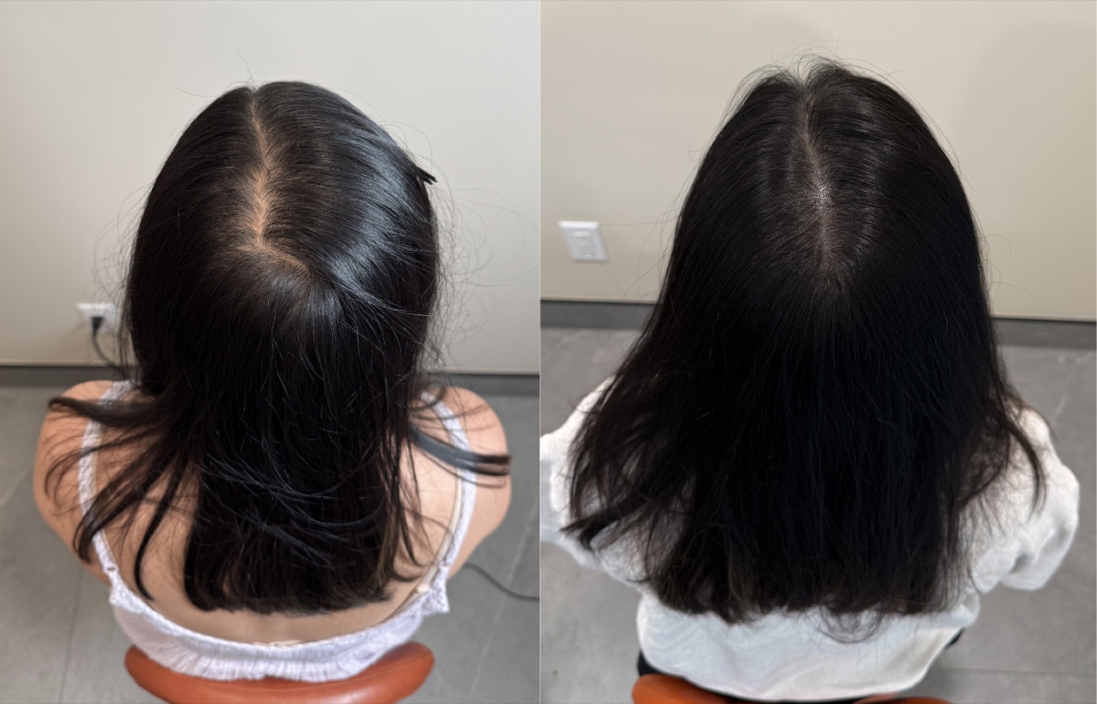 Hairline SMP portfolio 11
