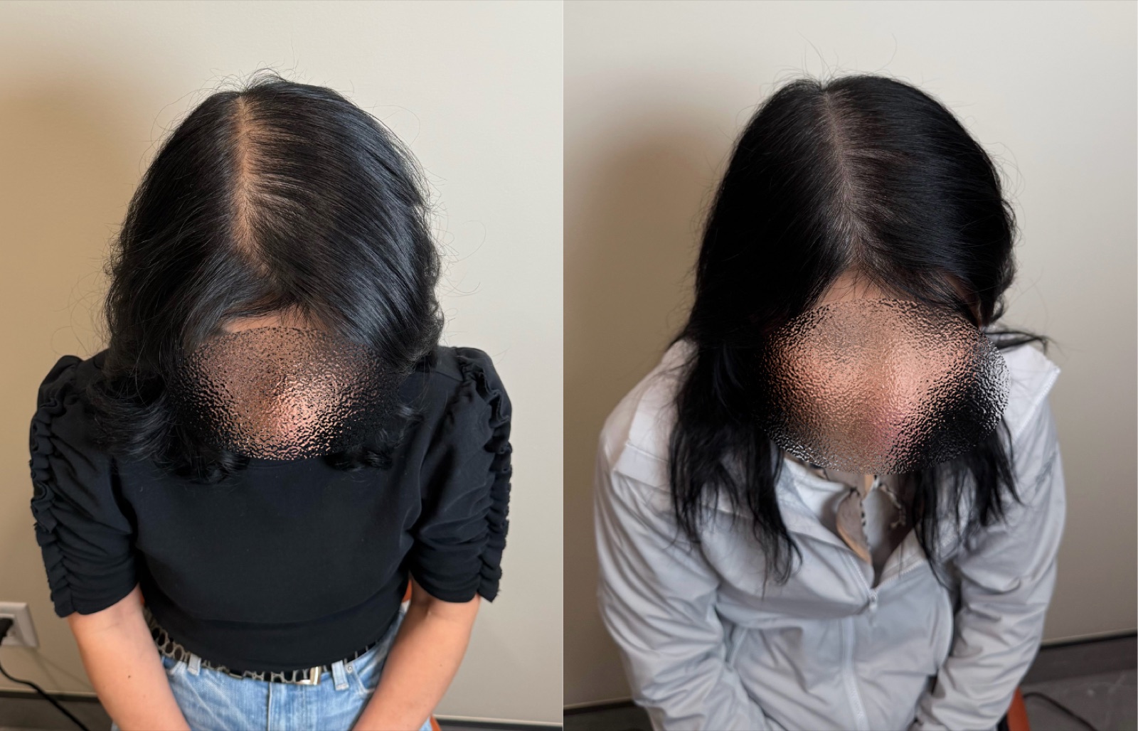 Hairline SMP portfolio 13