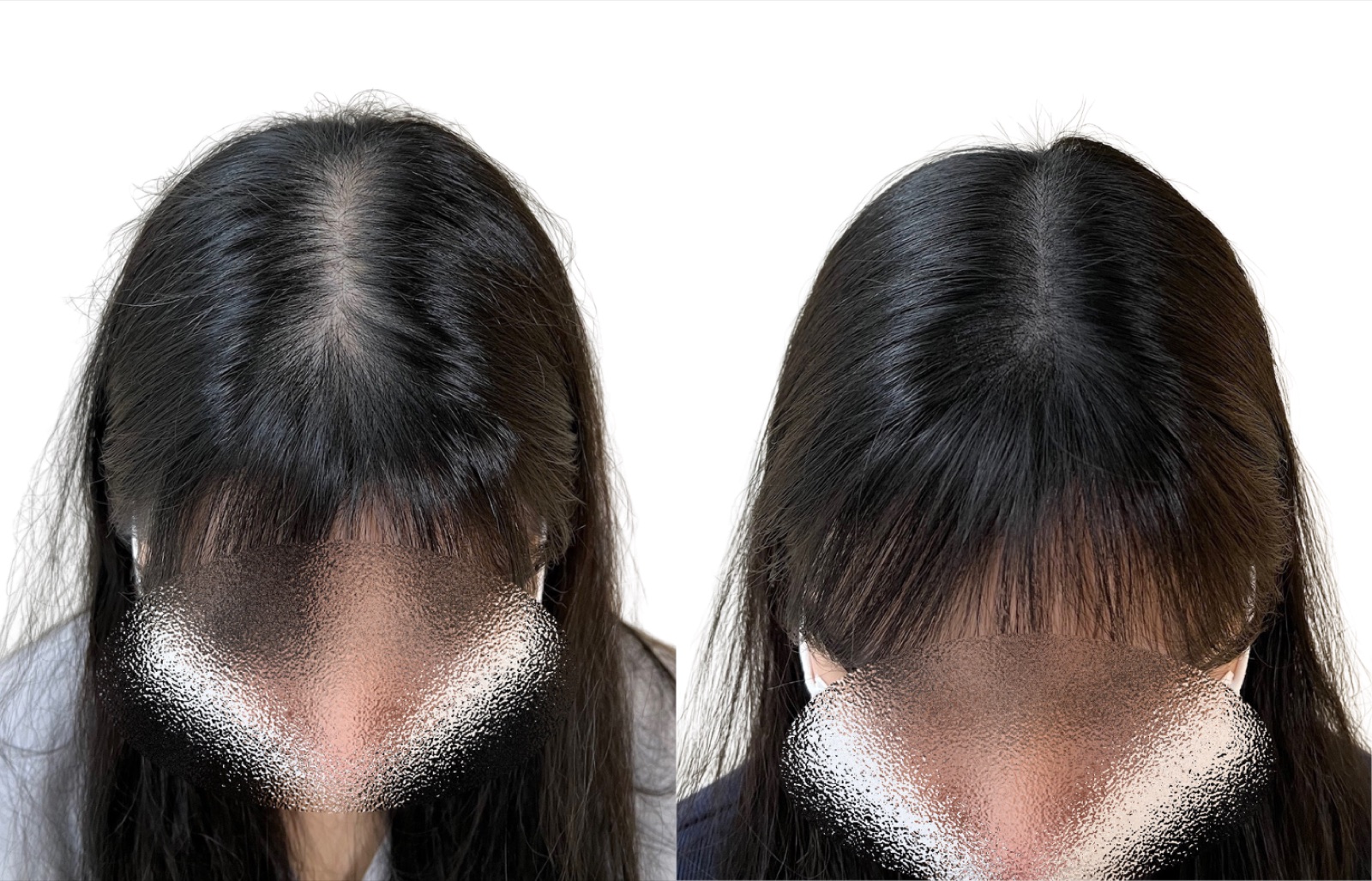 Hairline SMP portfolio 16