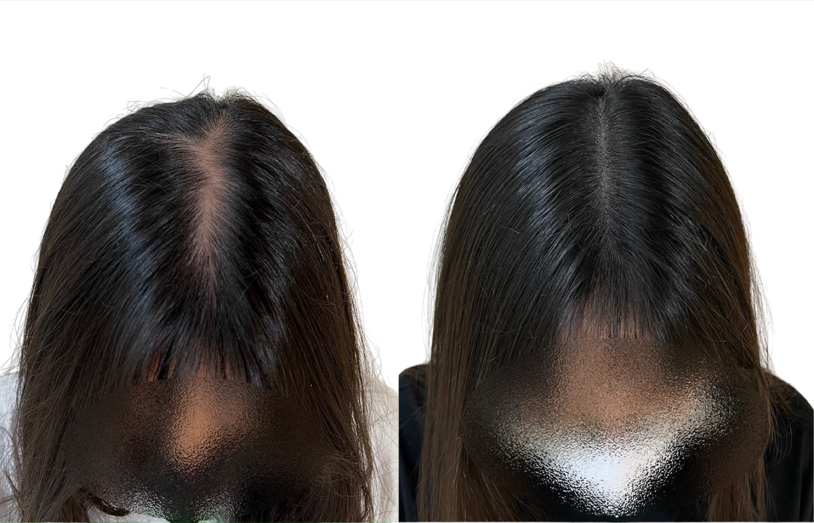 Hairline SMP portfolio 18